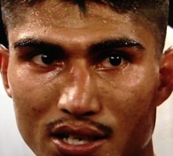 It wasn&#39;t supposed to end the way it did but <b>Mikey Garcia</b> (31-0-0, <b>...</b> - mikey.garcia.broken.nose.250w